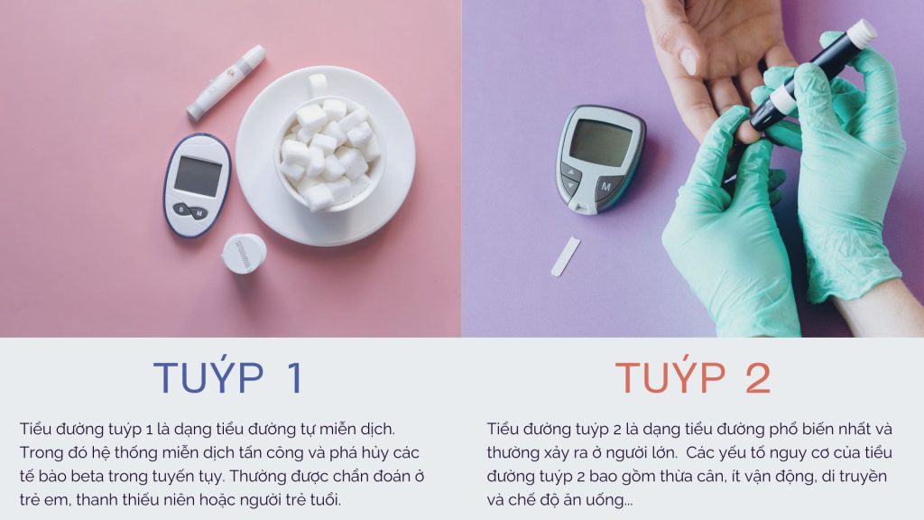 2 tuýp chính của bệnh tiểu đường