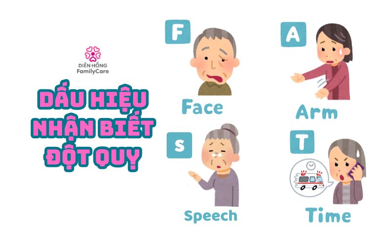 dau-hieu-nhan-biet-dot-quỵ