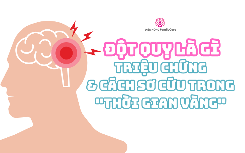 dot-quy-la-gi-nguyen-nhan-va-cach-khac-phuc7