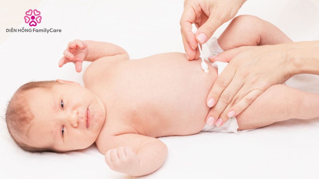 Chăm sóc trẻ sơ sinh vừa rụng rốn