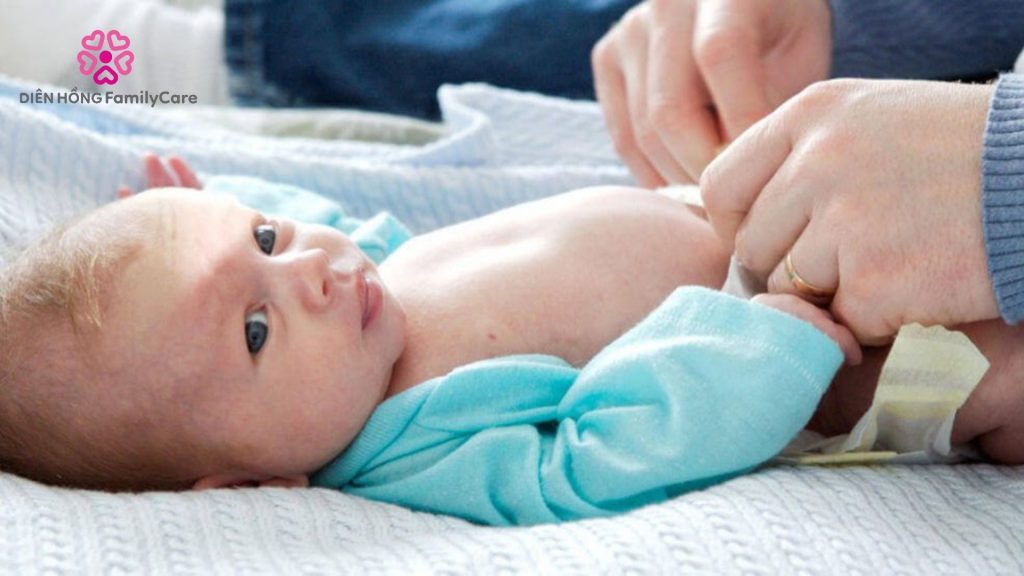 Chăm sóc rốn của trẻ sơ sinh