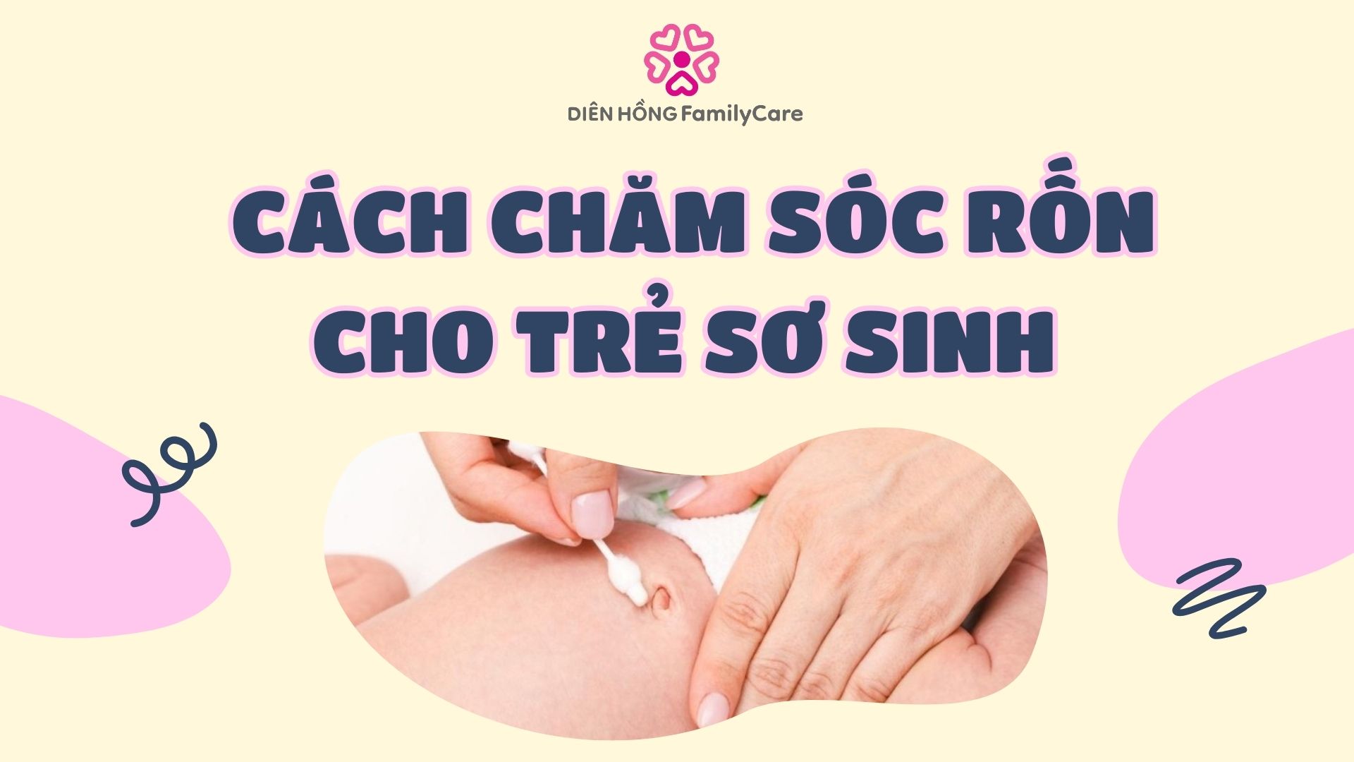 Chăm sóc rốn cho trẻ sơ sinh