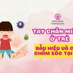 tay-chan-mieng-o-tre-dau-hieu-va-cach-cham-soc