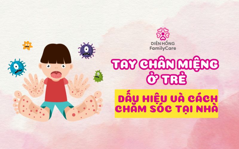 tay-chan-mieng-o-tre-dau-hieu-va-cach-cham-soc