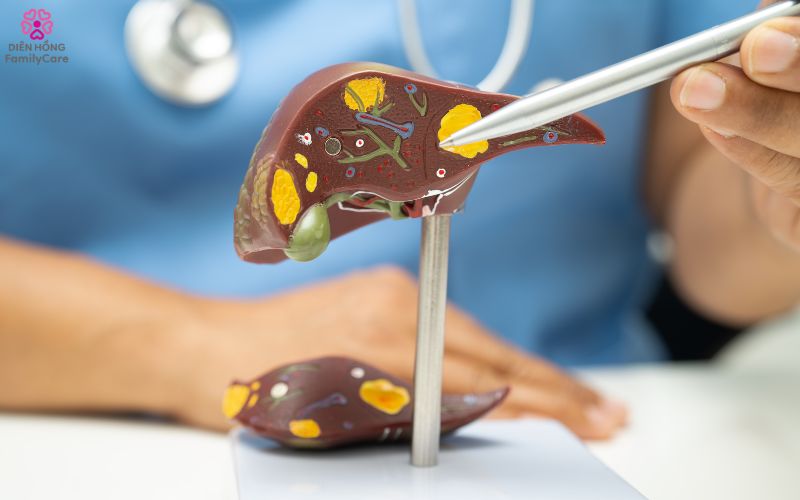 5-thoi-quen-xau-hai-gan