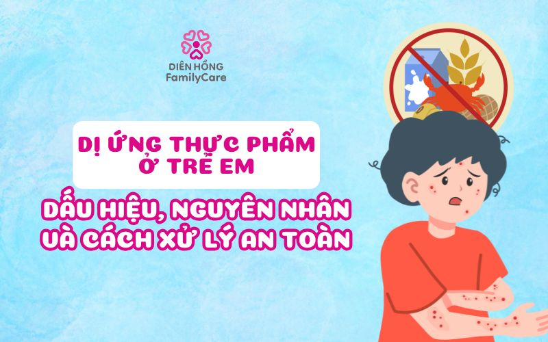 di-ung-thuc-pham-o-tre-em