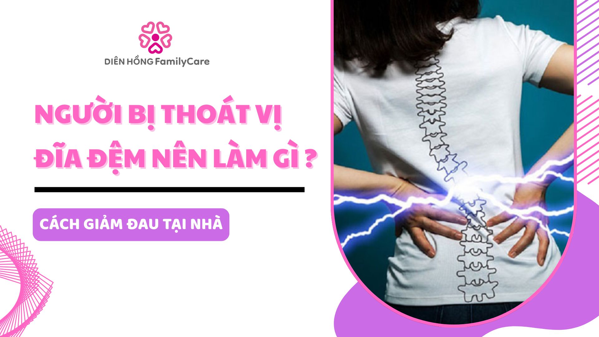 Người bị thoát vị đĩa đệm nên làm gì ?