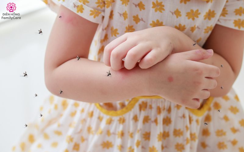 phong-sot-xuat-huyet-o-tre