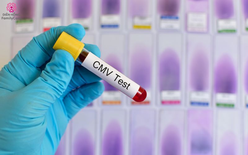 benh-cmv-lay-qua-nu-hon