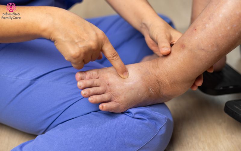 cham-soc-ban-chan-nguoi-tieu-duong