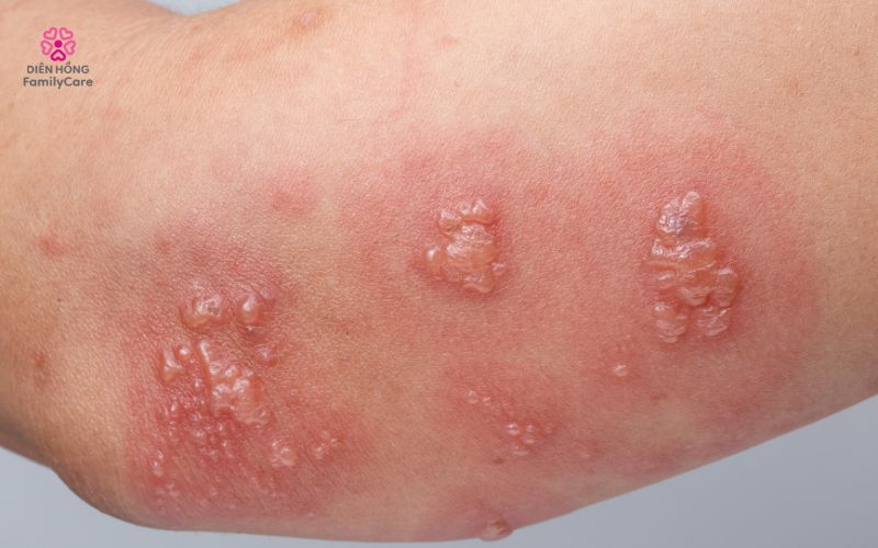 zona-than-kinh-o-nguoi-gia-2