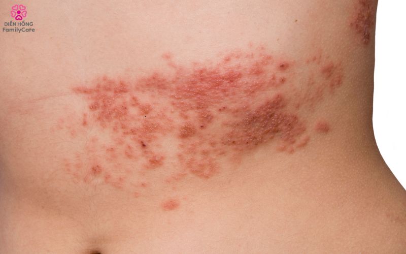 zona-than-kinh-o-nguoi-gia-3