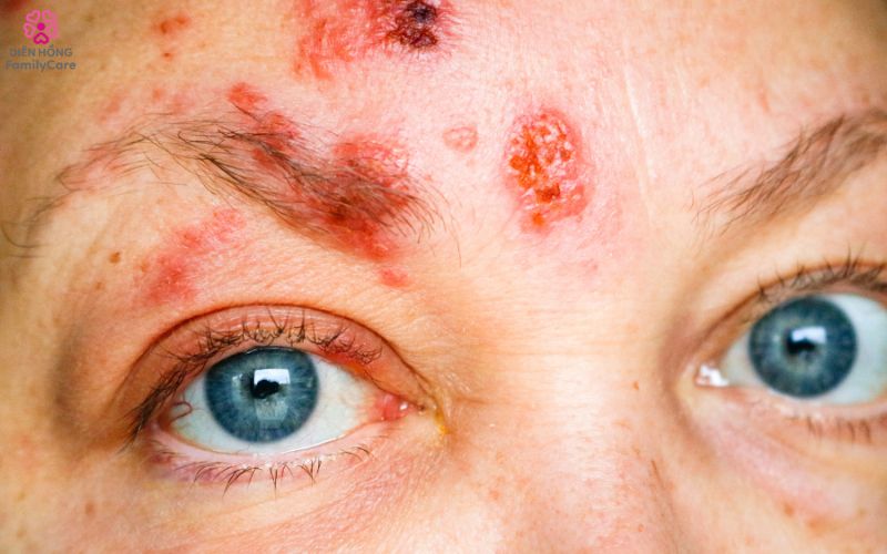 zona-than-kinh-o-nguoi-gia-4