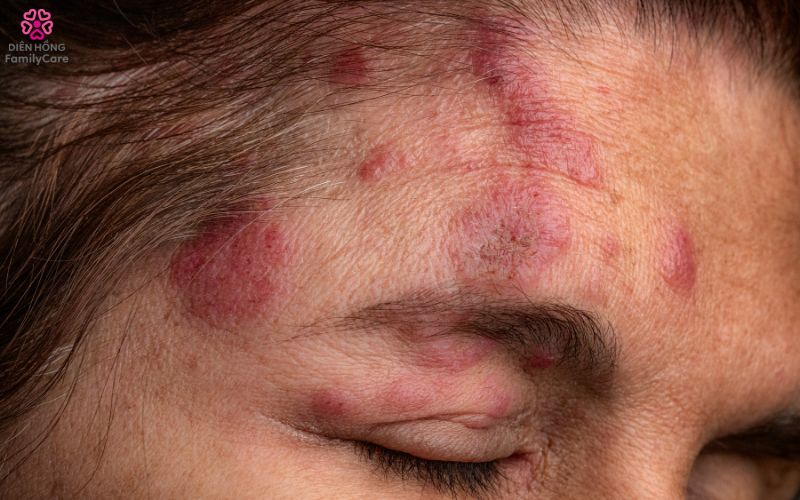 zona-than-kinh-o-nguoi-gia-5