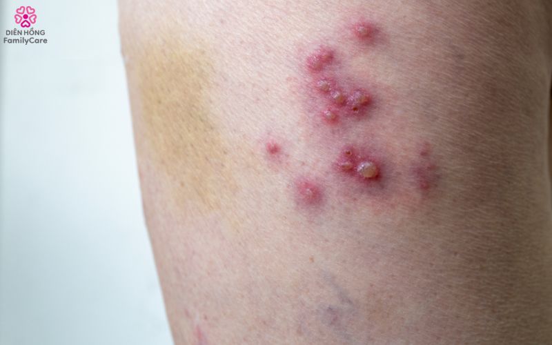 zona-than-kinh-o-nguoi-gia-6