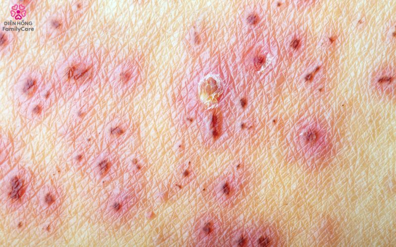 zona-than-kinh-o-nguoi-gia-8