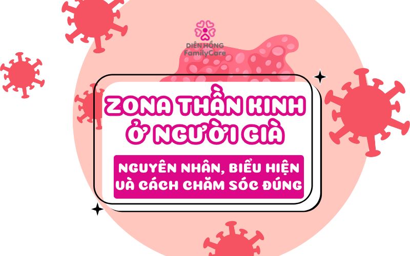 zona-than-kinh-o-nguoi-gia