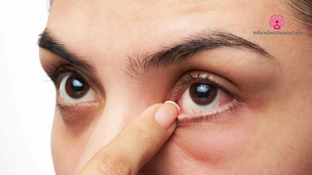 biểu hiện của biến chứng tiểu đường