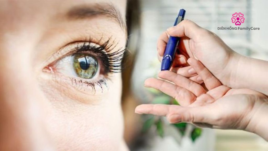 Kiểm tra định kỳ bệnh tiểu đường