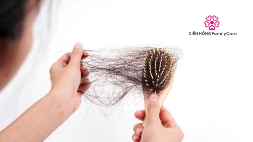 Hạn chế chải tóc quá nhiều