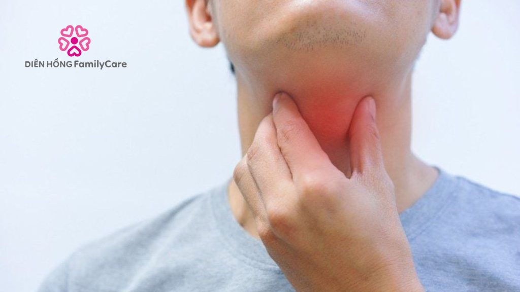 Dấu hiệu việc ho đau rát họng