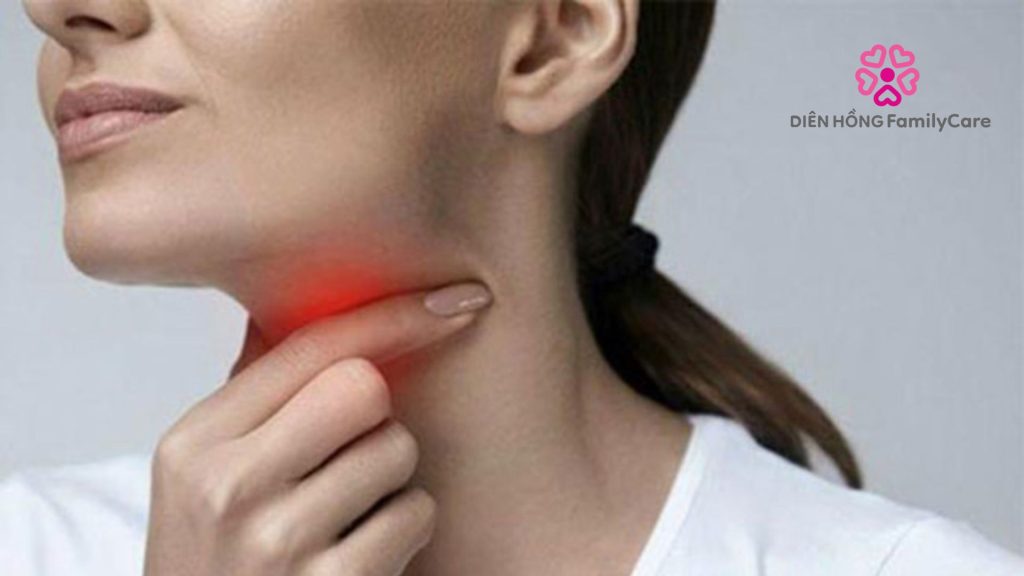 Viêm họng gây đau rát họng