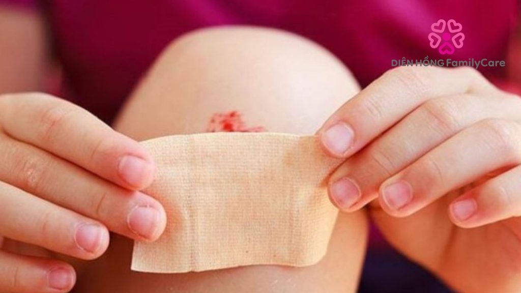 chăm sóc vết thưởng hở tại nhà