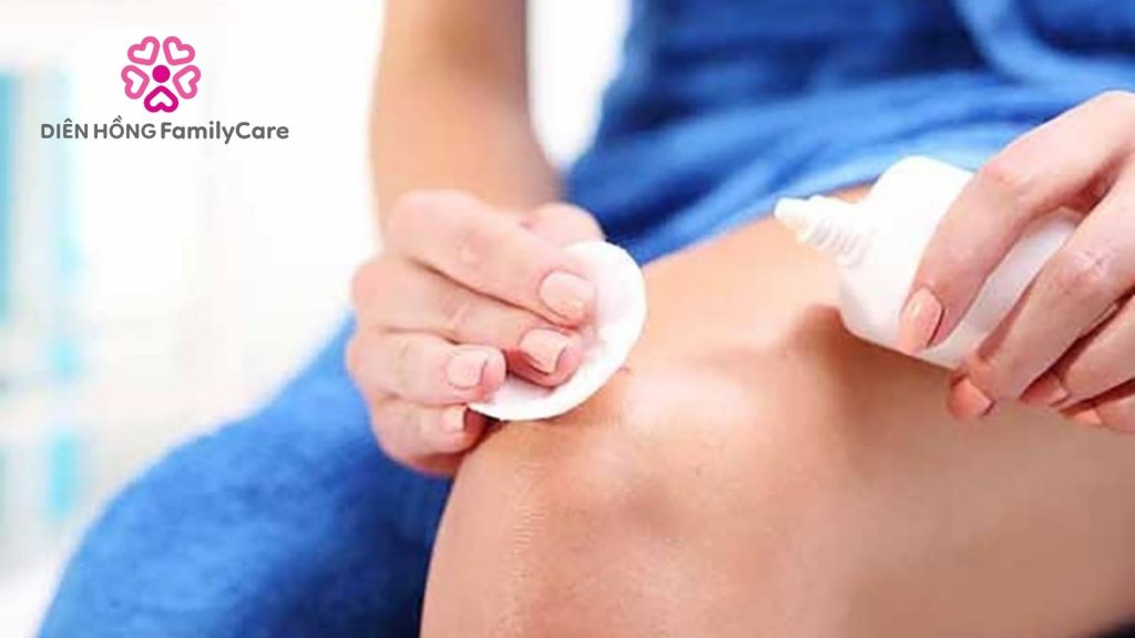 Vật dụng chuẩn bị để chăm sóc vết thương hở