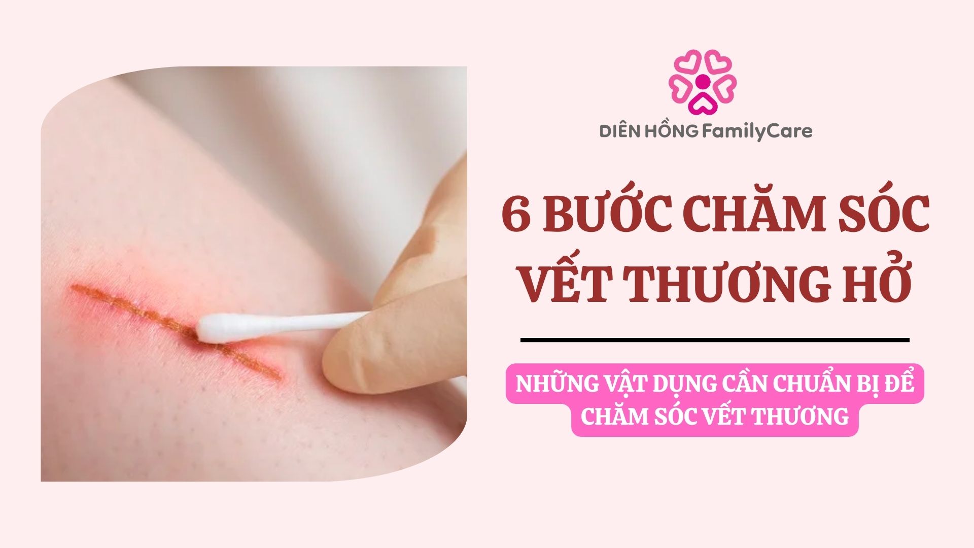 chăm sóc vết thương hở